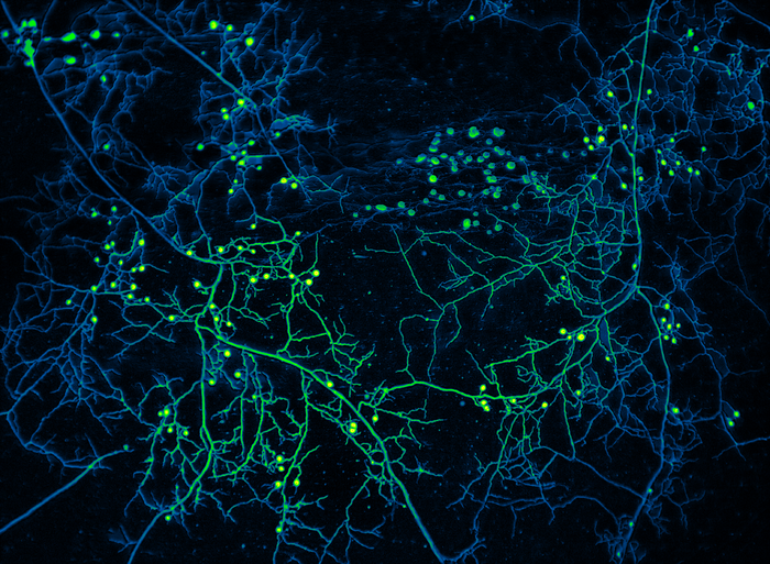 Mycelium of arbuscular mycorrhizal fungi with false color