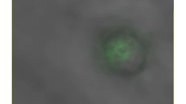 3-D Scan of a Pre-synaptic Terminal with Tagged Vesicles