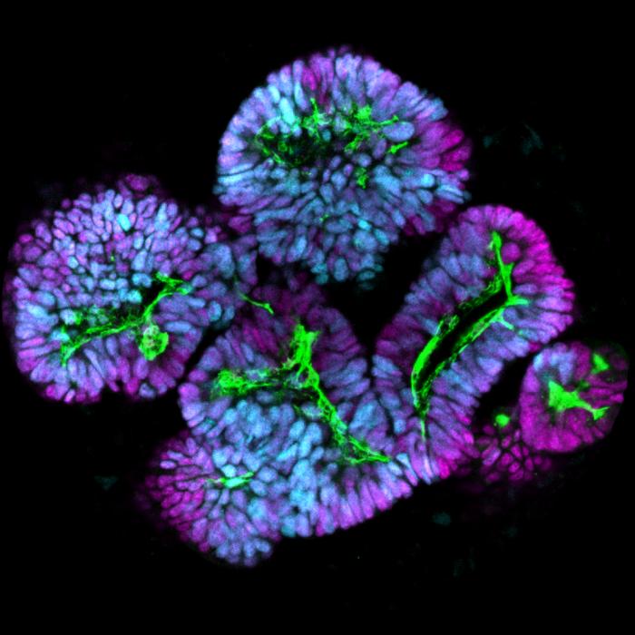 stem cell-derived nephrons