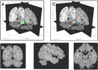 Brain Modulyzer