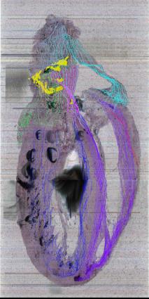 saggital image slab of heart with neurons