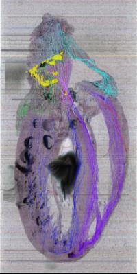 saggital image slab of heart with neurons