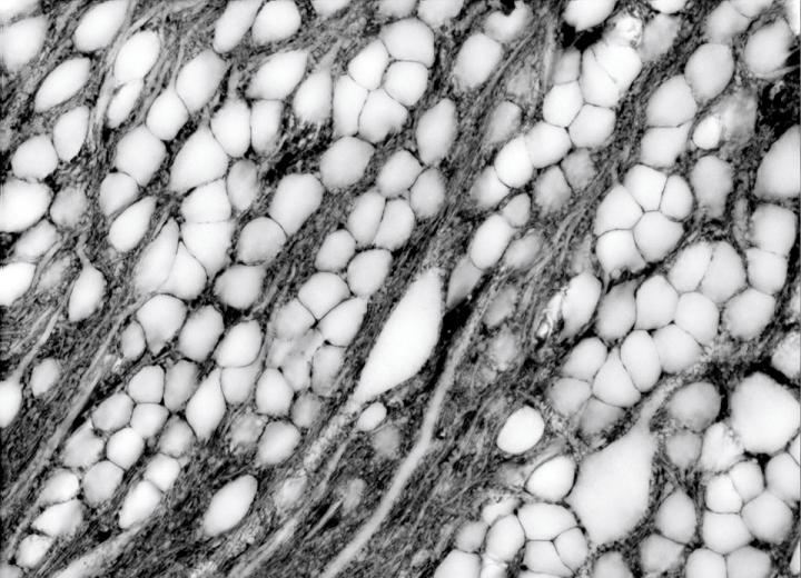 Extracellular Space