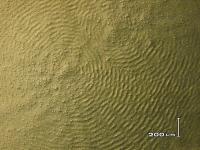 <i>M. xanthus</i> Waves (2 of 2)