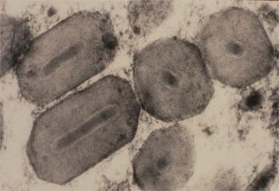 Granulovirus