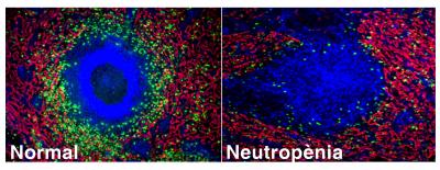 Immunofluorescence of Human Spleen