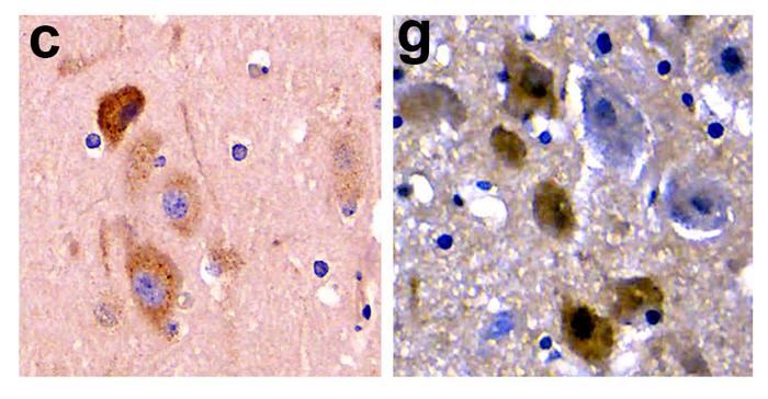 Alzheimer's pathology in the brain of a stranded dolphin