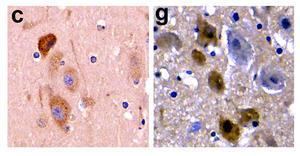 Alzheimer's pathology in the brain of a stranded dolphin