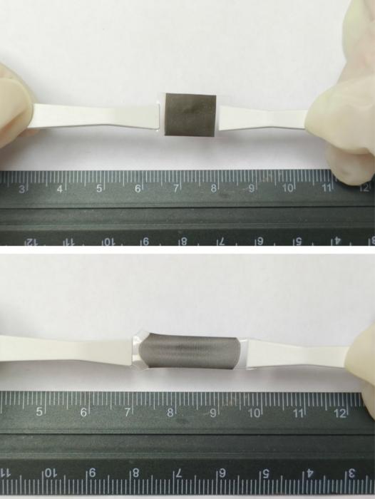 A stretchy, heat-activated skin patch could be a surgery-free melanoma treatment