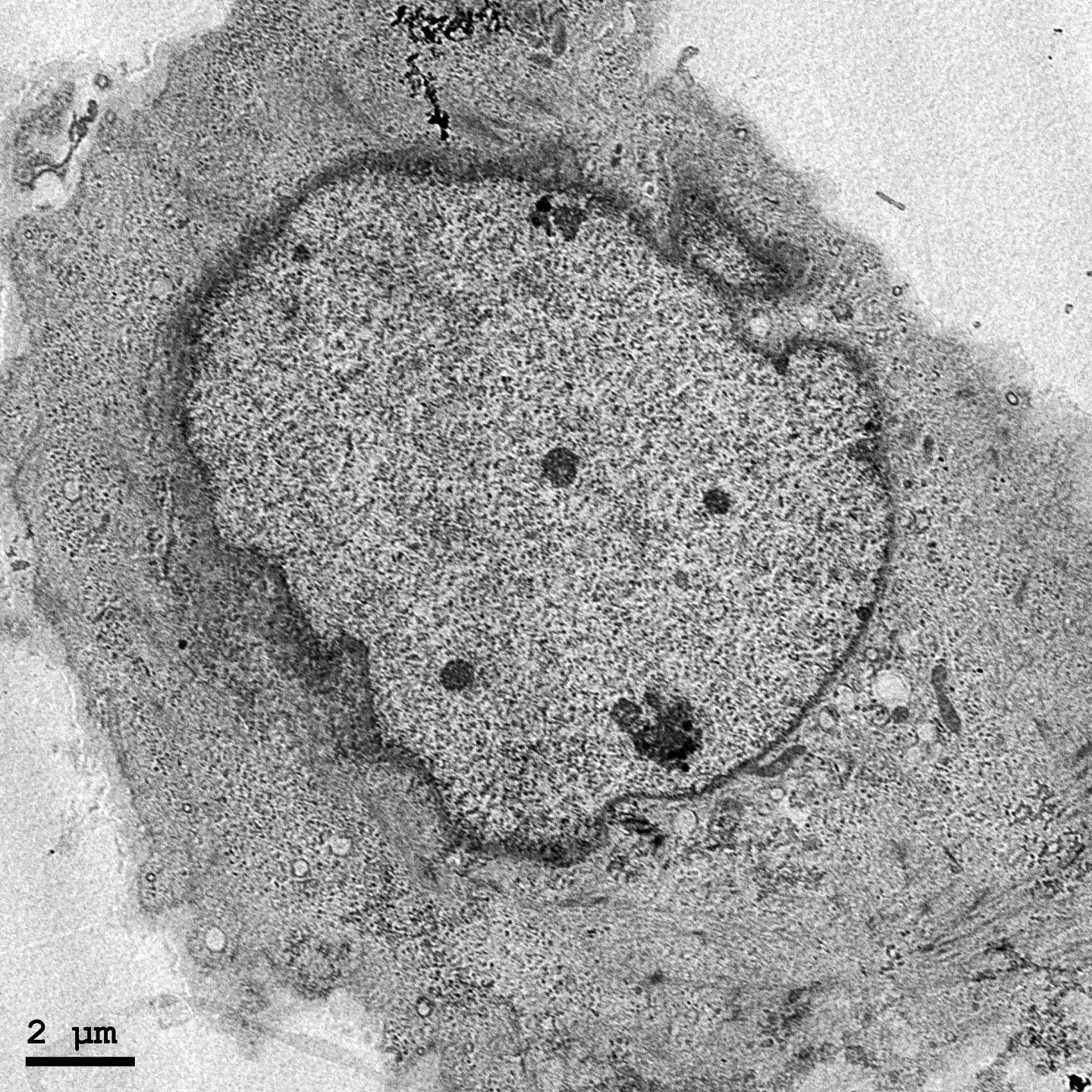 Cell Undergoing Necroptosis
