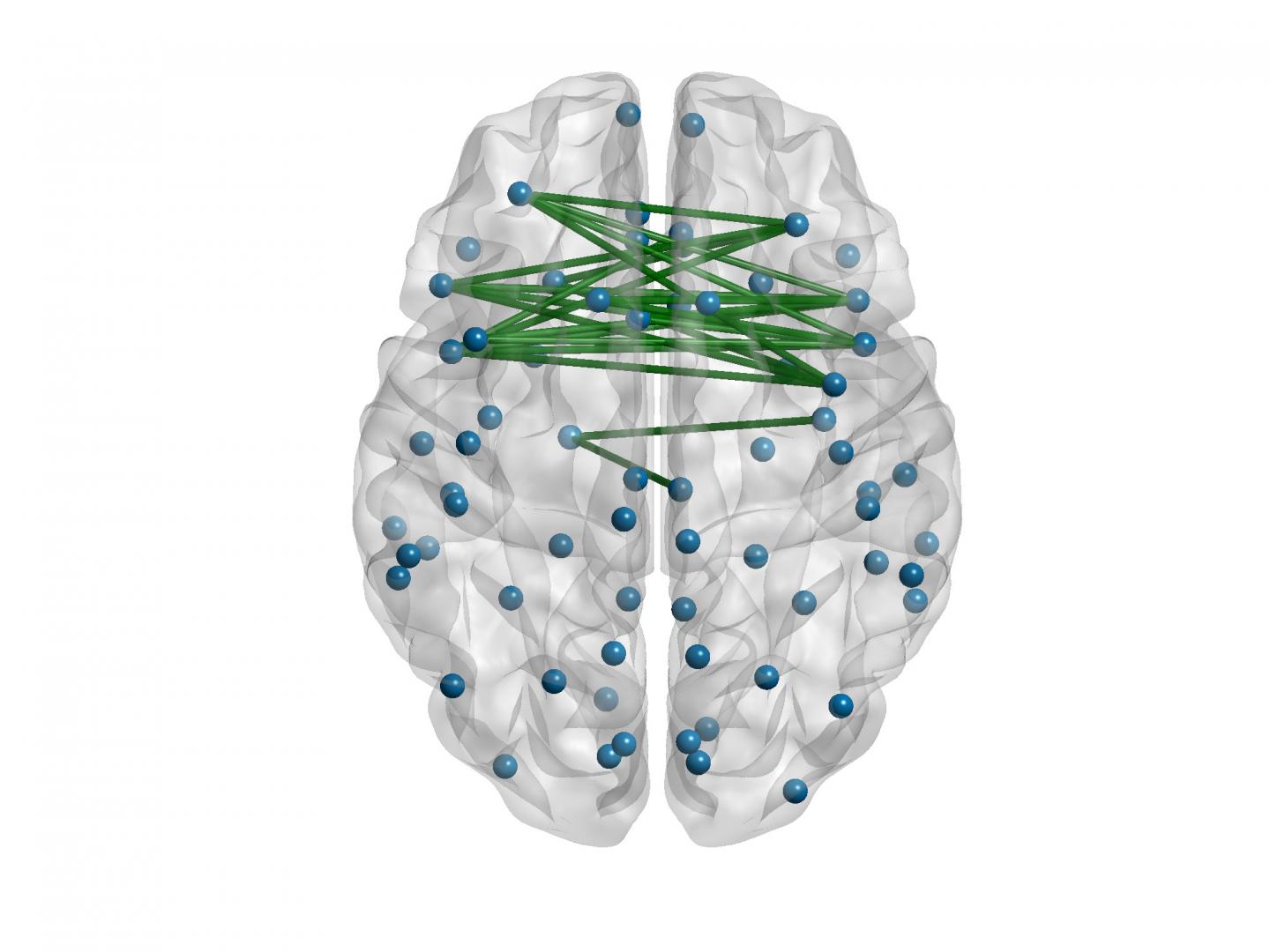 Creative People Have Better-Connected Brains