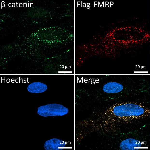 B-catenin and FMRP