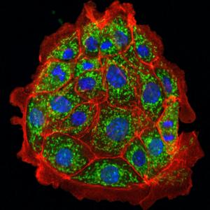 Kidney proximal tubule cells