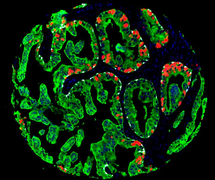 Prostate Tissue Section from Human Prostate Sample