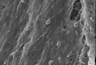 Neural Stem Cells