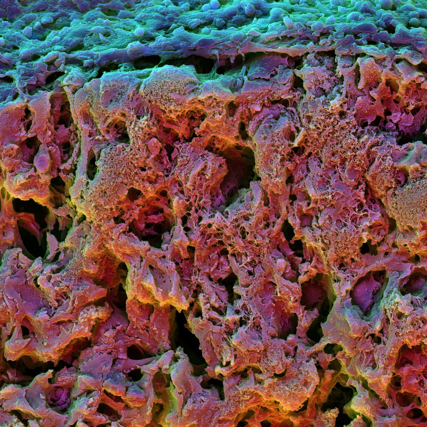 Cross Section of a Fast Relaxing Hydrogel (2 of 2)