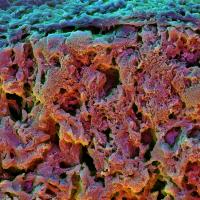 Cross Section of a Fast Relaxing Hydrogel (2 of 2)