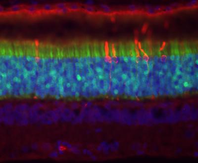 Reaching Rods With Gene Therapy