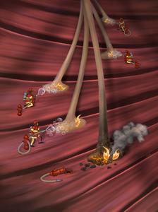 Illustration showing the gene therapy’s protective effect on motor neurons, preventing the “fire-like” degeneration characteristic of ALS.
