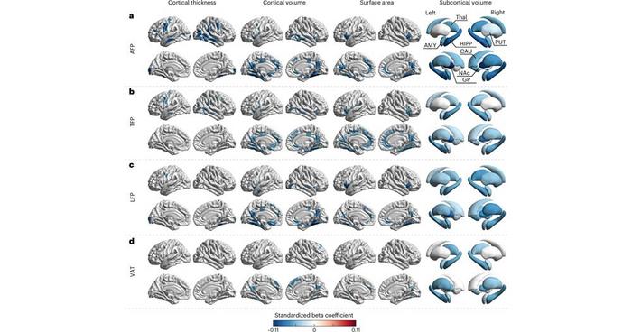 PolyU research reveals fat distribution as key to brain health, with visceral fat accumulation significantly accelerating brain ageing and showing much stronger association than BMI