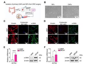 Highly purified fibroblasts were successfully obtained from human CRC tissues.