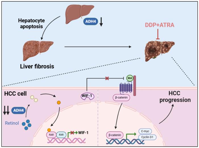 Alcohol dehydrogenase 4-mediated retinol metabolism inhibits hepatocellular carcinoma progression through inhibiting the Wnt/β-catenin pathway
