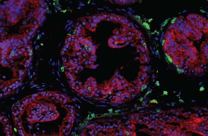 T cells in the prostate