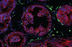 T cells in the prostate