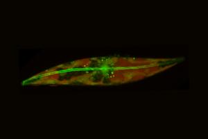 diatom