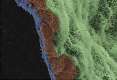 RPE Cells on the Biodegradable Scaffold