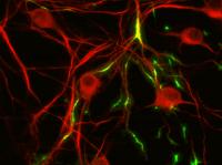 TREK1 Neurons