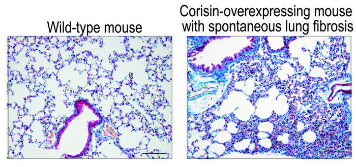 Corisin-induced pulmonary fibrosis