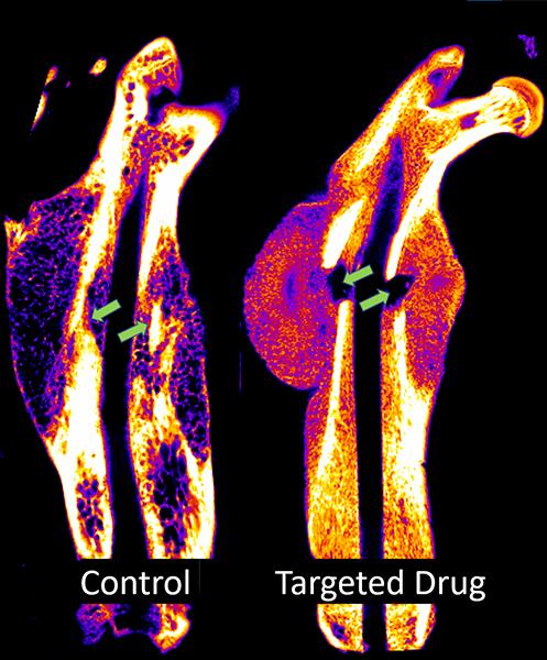 Bone X-ray showing treatment results