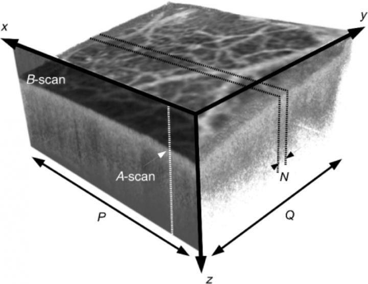 OCT Image Volume and Associated Coordinate System