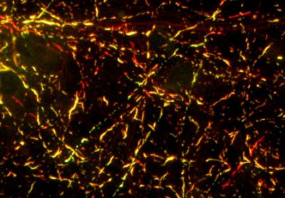 Effect of Strain B on Mouse Cells
