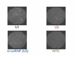 A Window to Spliceosome Assembly (2 of 4)