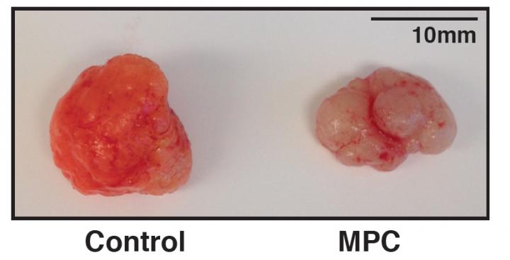 Tumor Growth