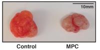 Tumor Growth
