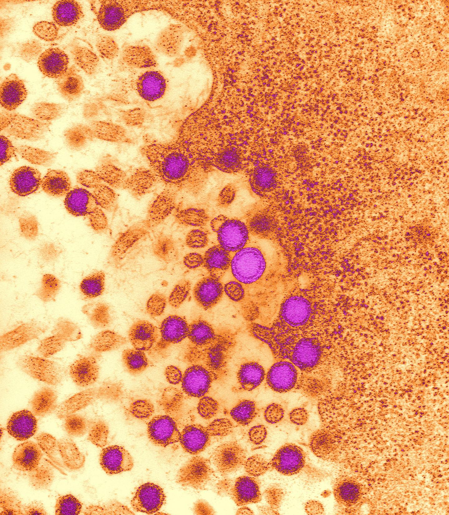 Wasps Captured Viruses in DNA as Part of Evolutionary Mechanism (7 of 8)