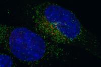 FGFR3-TACC3 Fusion