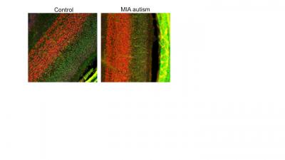 Autism Risk Determined by Health of Expectant Mother's Gut, UVA Research Reveals