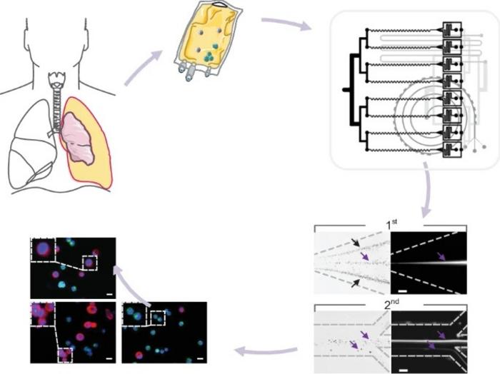 Two-stage microfluidic enrichment of tumor cells and clusters.