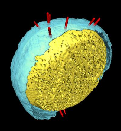 <I>Yersinia</I> Injectisome