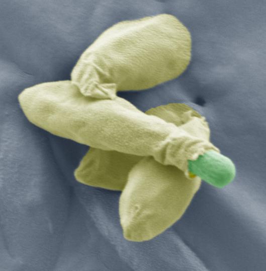 <i>Clostridium</i> Spore Germinating (1 of 2)