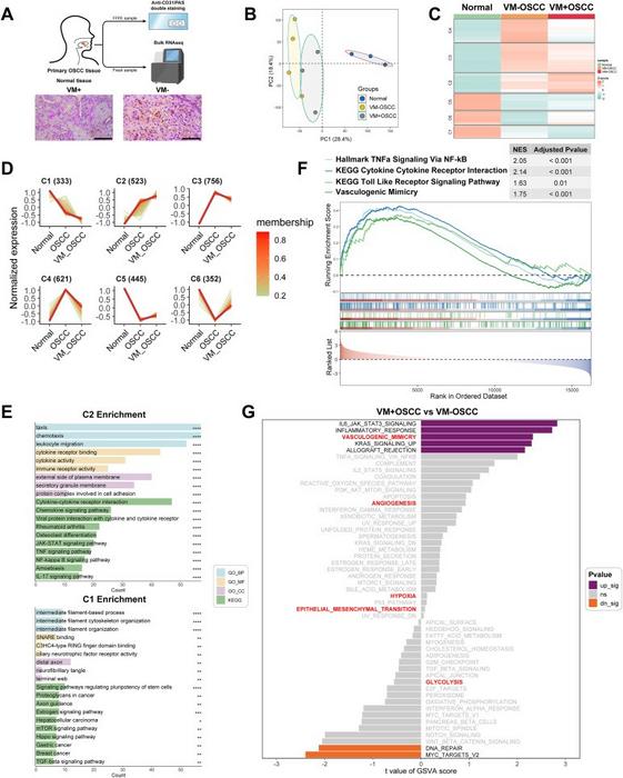 Transcriptomic profiling reveals key insights into the formation of vasculogenic mimicry (VM) in oral squamous cell carcinoma (OSCC)