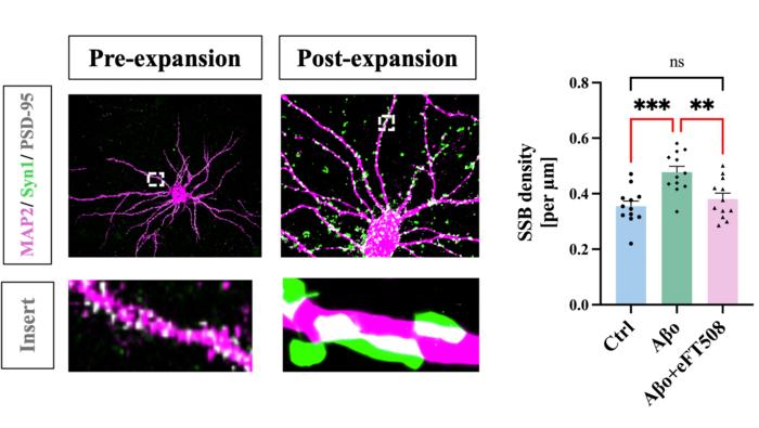 Neurons exposed to amyloid-beta formed more connections  which could be lessened with cancer drug eFT508.