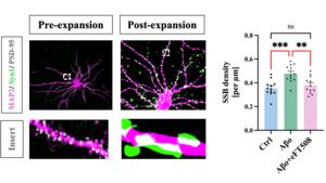 Neurons exposed to amyloid-beta formed more connections  which could be lessened with cancer drug eFT508.