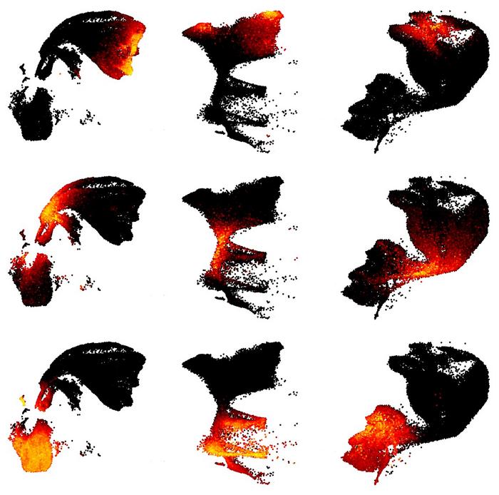 The Developing Neocortex