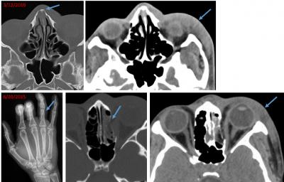 Radiology Images