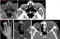 Radiology Images